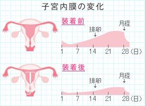 子宮内膜の変化